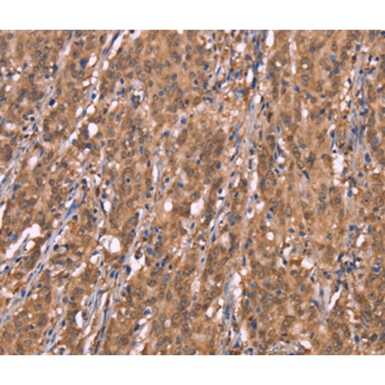 Immunohistochemistry - FBXO31 Antibody from Signalway Antibody (37567) - Antibodies.com
