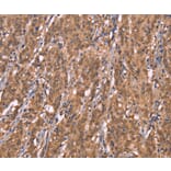 Immunohistochemistry - FBXO31 Antibody from Signalway Antibody (37567) - Antibodies.com