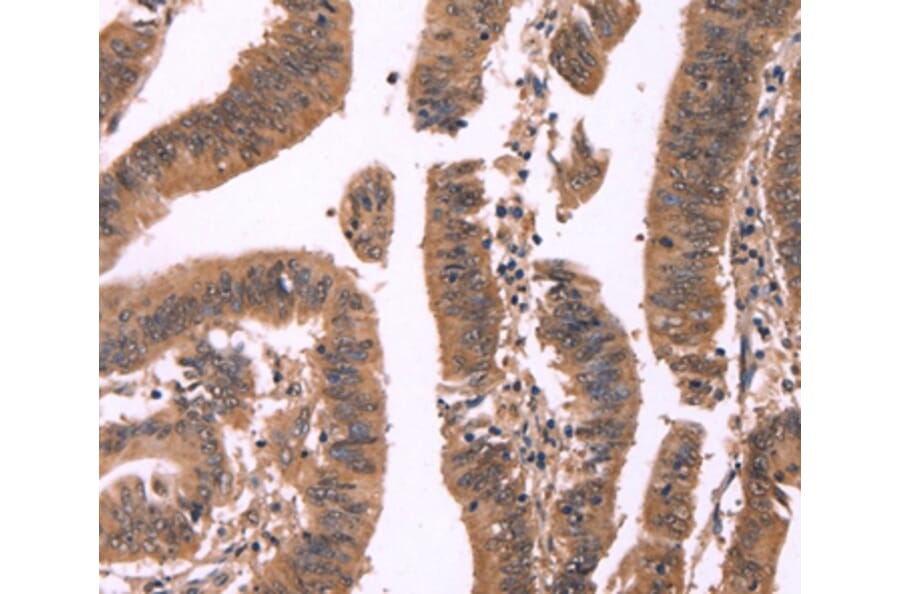 Immunohistochemistry - FBXO31 Antibody from Signalway Antibody (37567) - Antibodies.com