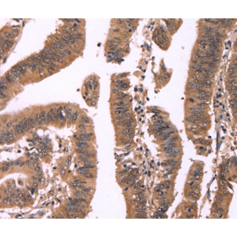 Immunohistochemistry - FBXO31 Antibody from Signalway Antibody (37567) - Antibodies.com