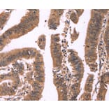 Immunohistochemistry - FBXO31 Antibody from Signalway Antibody (37567) - Antibodies.com