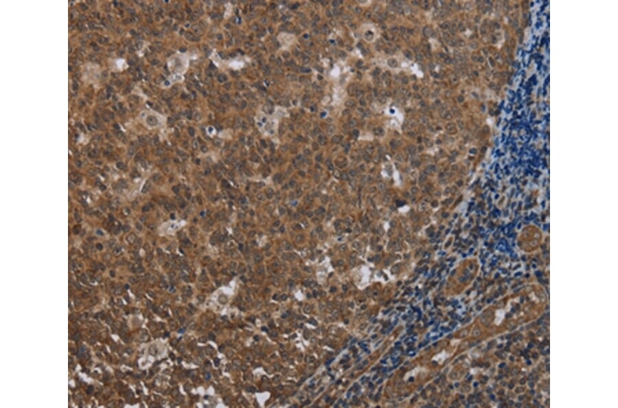 Immunohistochemistry - FOLH1B Antibody from Signalway Antibody (37575) - Antibodies.com