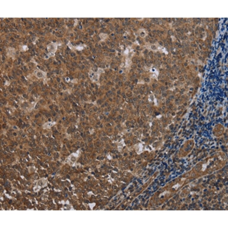 Immunohistochemistry - FOLH1B Antibody from Signalway Antibody (37575) - Antibodies.com