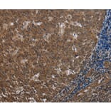 Immunohistochemistry - FOLH1B Antibody from Signalway Antibody (37575) - Antibodies.com