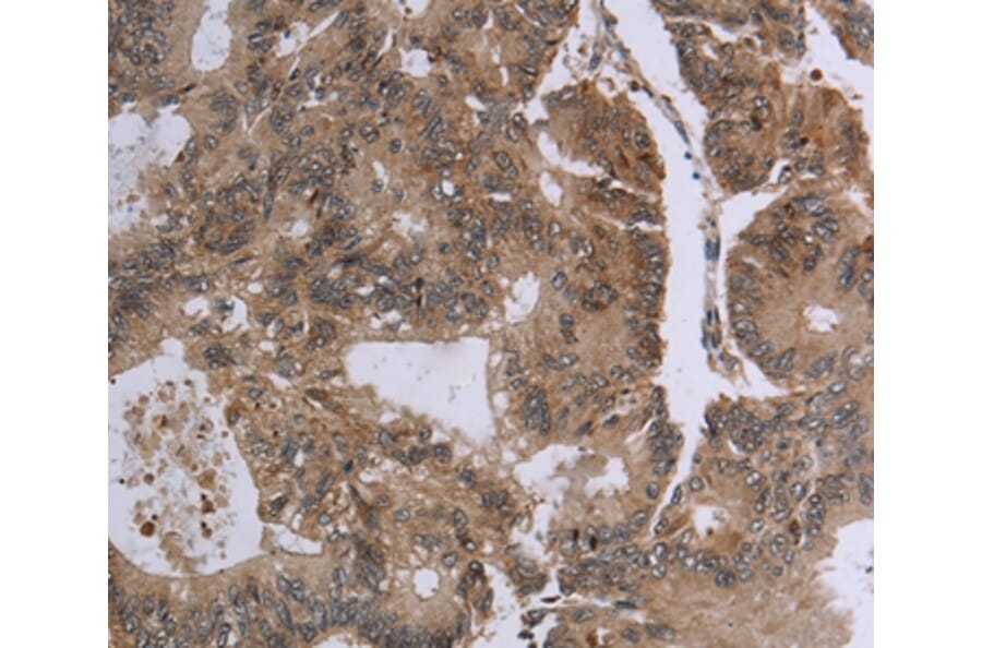 Immunohistochemistry - FOLH1B Antibody from Signalway Antibody (37575) - Antibodies.com