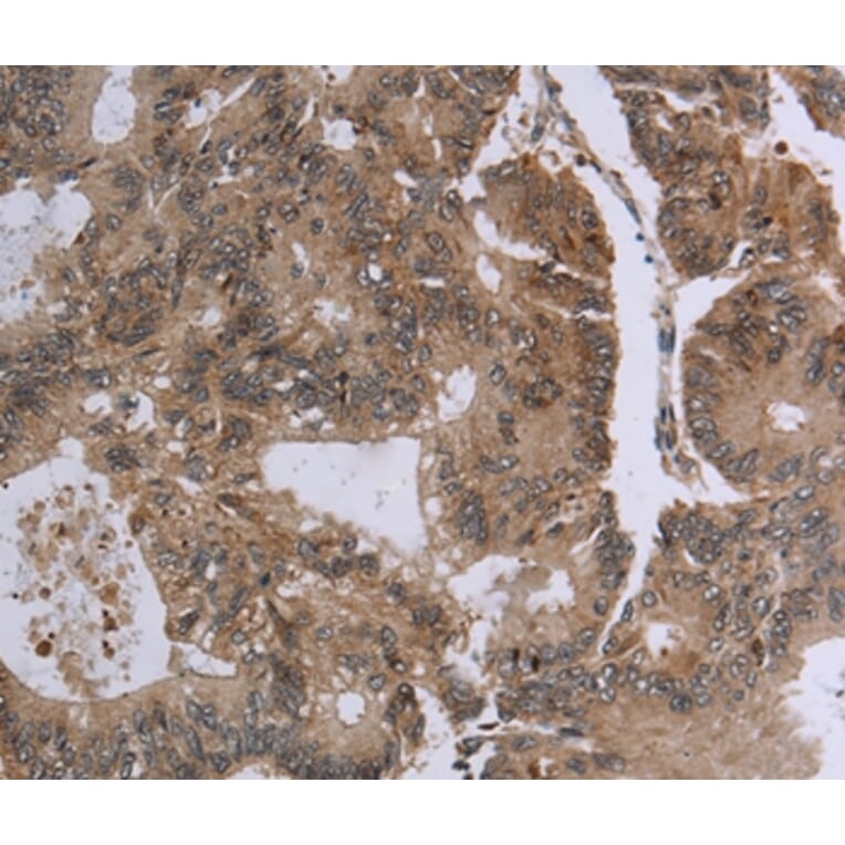 Immunohistochemistry - FOLH1B Antibody from Signalway Antibody (37575) - Antibodies.com