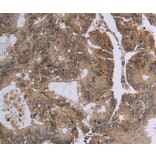 Immunohistochemistry - FOLH1B Antibody from Signalway Antibody (37575) - Antibodies.com