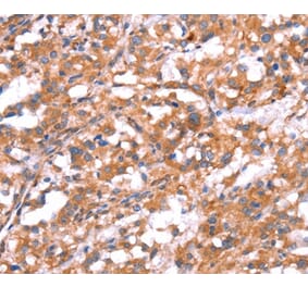 Immunohistochemistry - GABBR1 Antibody from Signalway Antibody (37582) - Antibodies.com