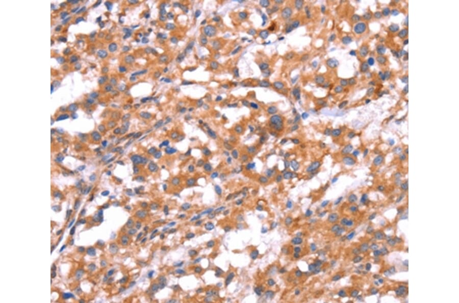 Immunohistochemistry - GABBR1 Antibody from Signalway Antibody (37582) - Antibodies.com
