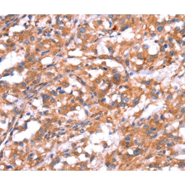 Immunohistochemistry - GABBR1 Antibody from Signalway Antibody (37582) - Antibodies.com