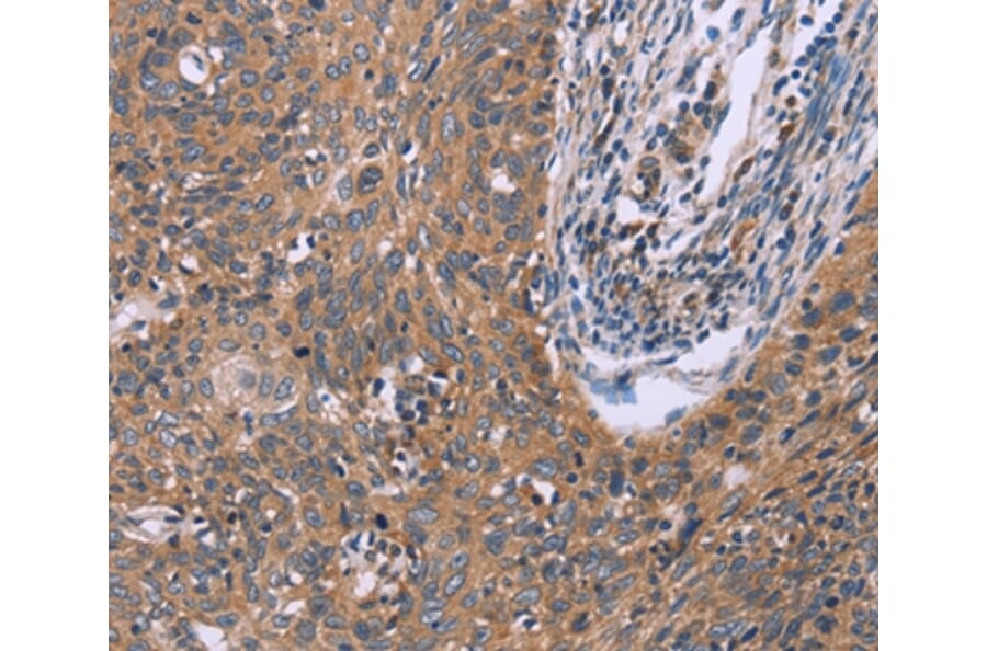 Immunohistochemistry - CSF2RB Antibody from Signalway Antibody (37599) - Antibodies.com
