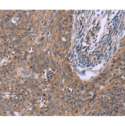 Immunohistochemistry - CSF2RB Antibody from Signalway Antibody (37599) - Antibodies.com