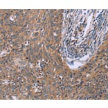 Immunohistochemistry - CSF2RB Antibody from Signalway Antibody (37599) - Antibodies.com