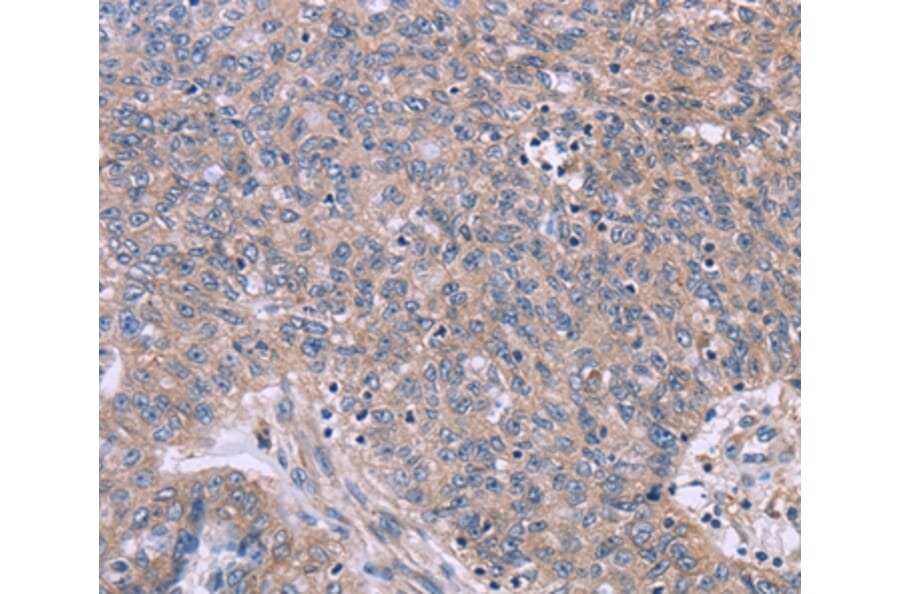 Immunohistochemistry - CSF2RB Antibody from Signalway Antibody (37599) - Antibodies.com