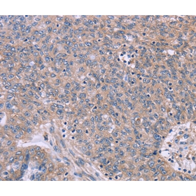 Immunohistochemistry - CSF2RB Antibody from Signalway Antibody (37599) - Antibodies.com