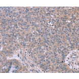 Immunohistochemistry - CSF2RB Antibody from Signalway Antibody (37599) - Antibodies.com
