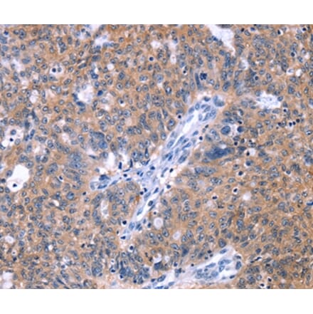 Immunohistochemistry - ZNF395 Antibody from Signalway Antibody (37614) - Antibodies.com