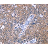 Immunohistochemistry - ZNF395 Antibody from Signalway Antibody (37614) - Antibodies.com