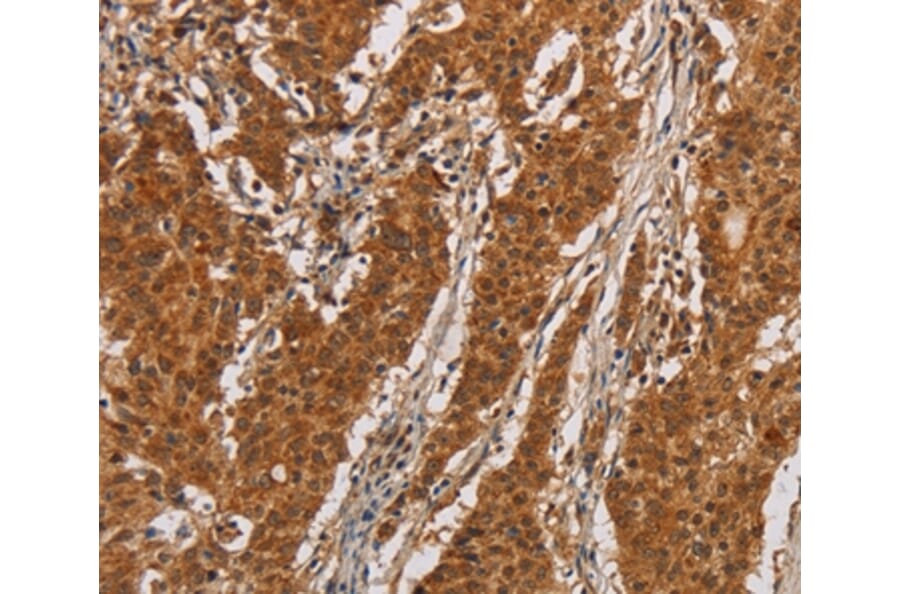 Immunohistochemistry - IL17RA Antibody from Signalway Antibody (37648) - Antibodies.com
