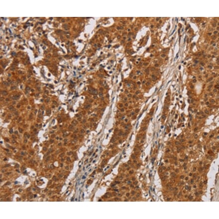 Immunohistochemistry - IL17RA Antibody from Signalway Antibody (37648) - Antibodies.com