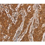 Immunohistochemistry - IL17RA Antibody from Signalway Antibody (37648) - Antibodies.com