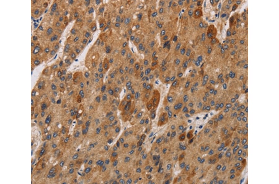 Immunohistochemistry - IL17RA Antibody from Signalway Antibody (37648) - Antibodies.com