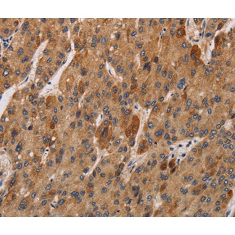 Immunohistochemistry - IL17RA Antibody from Signalway Antibody (37648) - Antibodies.com