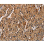 Immunohistochemistry - IL17RA Antibody from Signalway Antibody (37648) - Antibodies.com