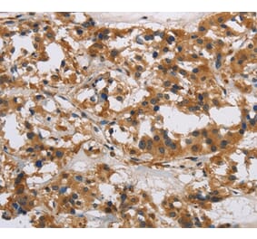 Immunohistochemistry - IL17RB Antibody from Signalway Antibody (37649) - Antibodies.com