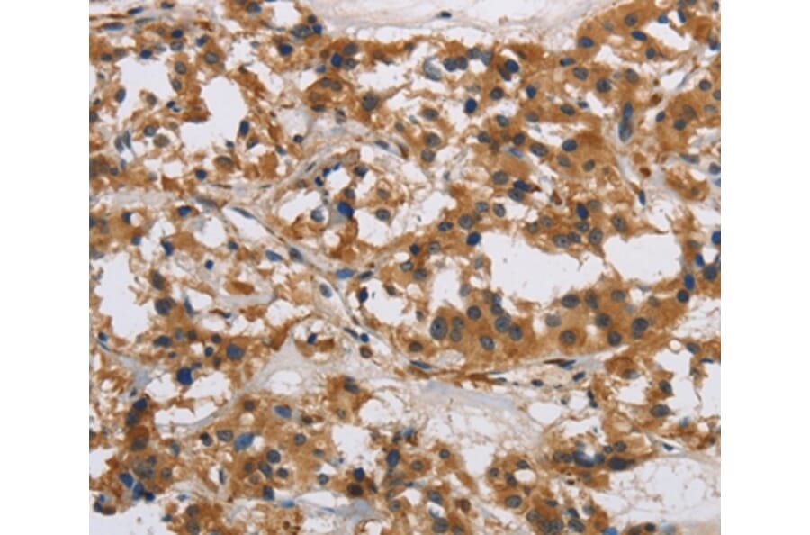 Immunohistochemistry - IL17RB Antibody from Signalway Antibody (37649) - Antibodies.com