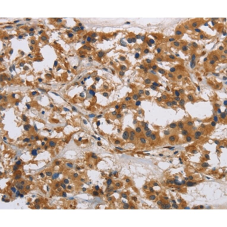 Immunohistochemistry - IL17RB Antibody from Signalway Antibody (37649) - Antibodies.com