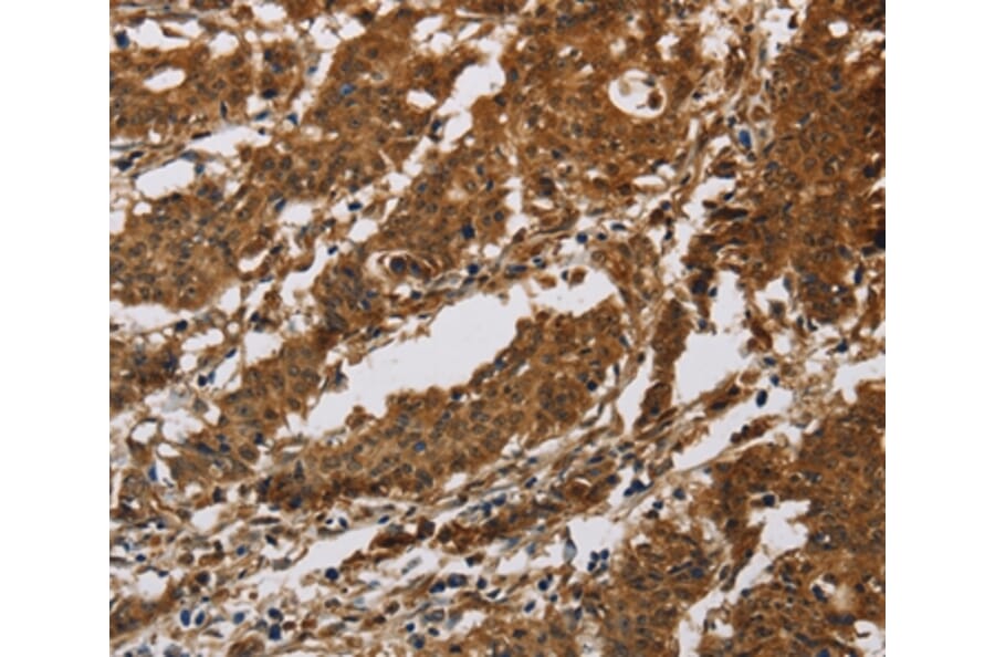 Immunohistochemistry - IL17RB Antibody from Signalway Antibody (37649) - Antibodies.com