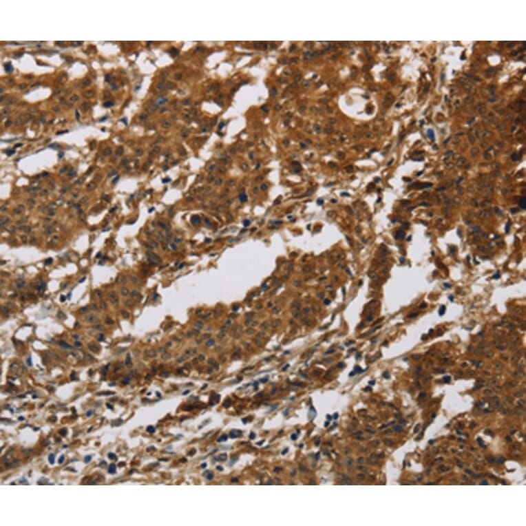 Immunohistochemistry - IL17RB Antibody from Signalway Antibody (37649) - Antibodies.com