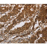 Immunohistochemistry - IL17RB Antibody from Signalway Antibody (37649) - Antibodies.com