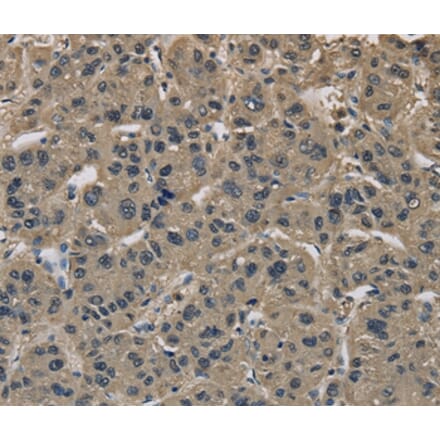 Immunohistochemistry - IMPAD1 Antibody from Signalway Antibody (37654) - Antibodies.com