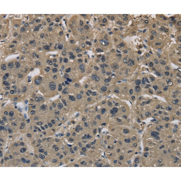 Immunohistochemistry - IMPAD1 Antibody from Signalway Antibody (37654) - Antibodies.com