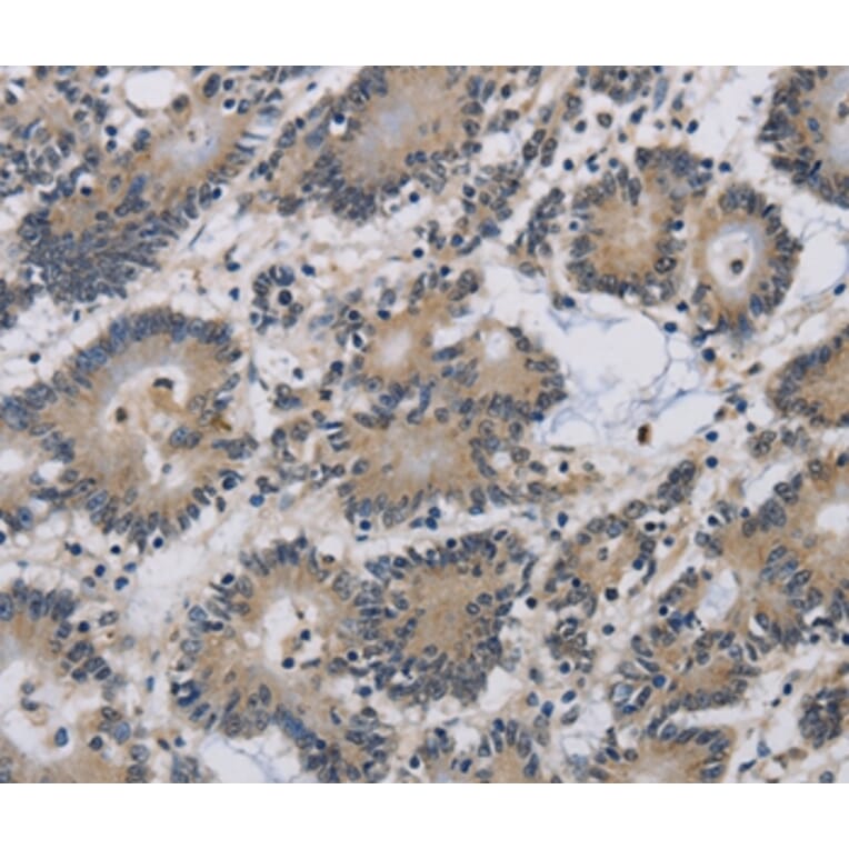 Immunohistochemistry - IMPAD1 Antibody from Signalway Antibody (37654) - Antibodies.com