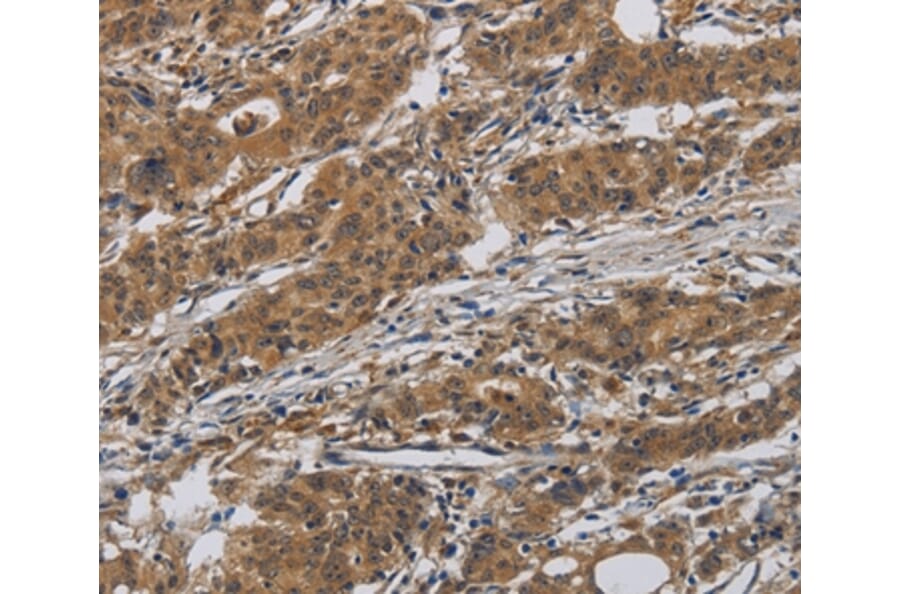 Immunohistochemistry - INPPL1 Antibody from Signalway Antibody (37660) - Antibodies.com