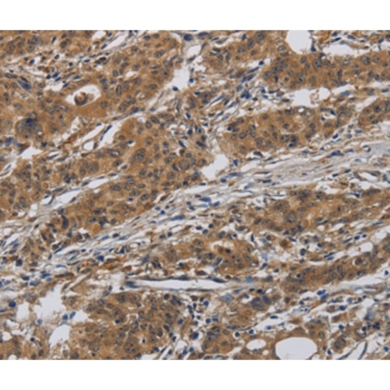 Immunohistochemistry - INPPL1 Antibody from Signalway Antibody (37660) - Antibodies.com