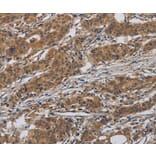 Immunohistochemistry - INPPL1 Antibody from Signalway Antibody (37660) - Antibodies.com