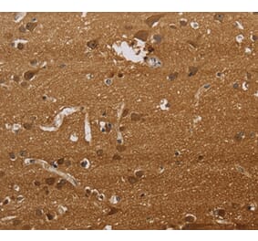 Immunohistochemistry - ELAVL2 Antibody from Signalway Antibody (37685) - Antibodies.com