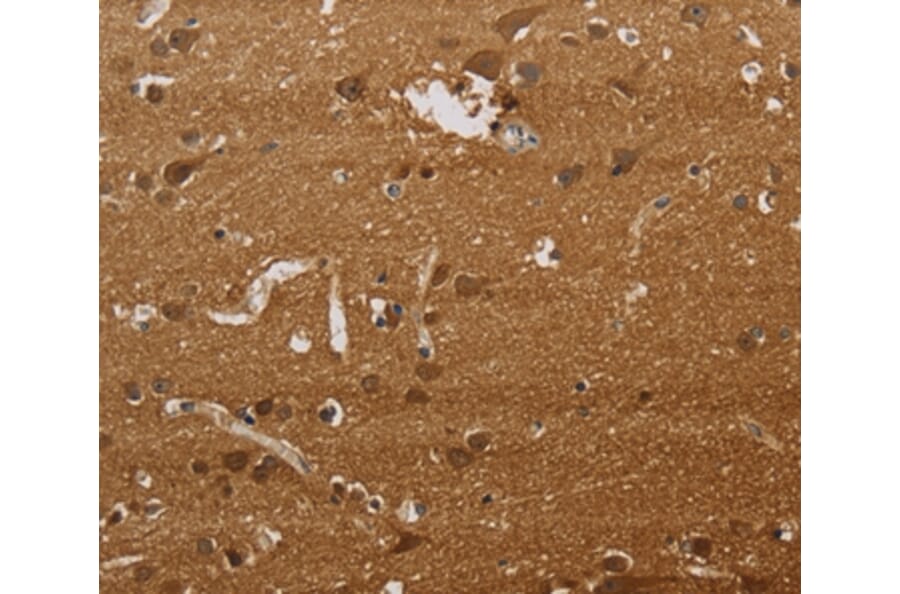 Immunohistochemistry - ELAVL2 Antibody from Signalway Antibody (37685) - Antibodies.com