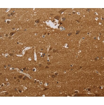 Immunohistochemistry - ELAVL2 Antibody from Signalway Antibody (37685) - Antibodies.com