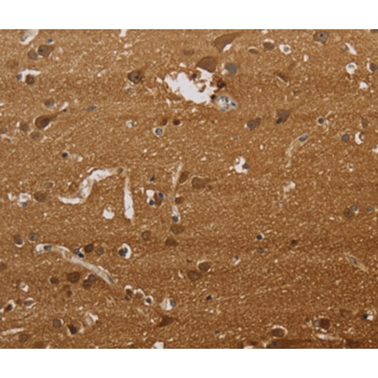 Immunohistochemistry - ELAVL2 Antibody from Signalway Antibody (37685) - Antibodies.com