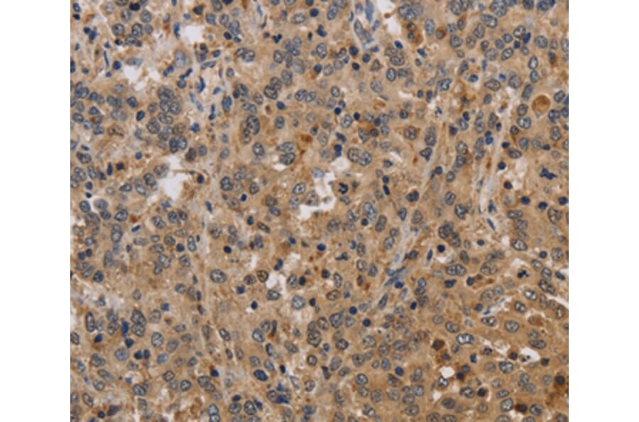 Immunohistochemistry - ELAVL2 Antibody from Signalway Antibody (37685) - Antibodies.com