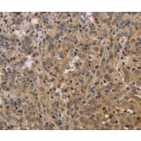 Immunohistochemistry - ELAVL2 Antibody from Signalway Antibody (37685) - Antibodies.com