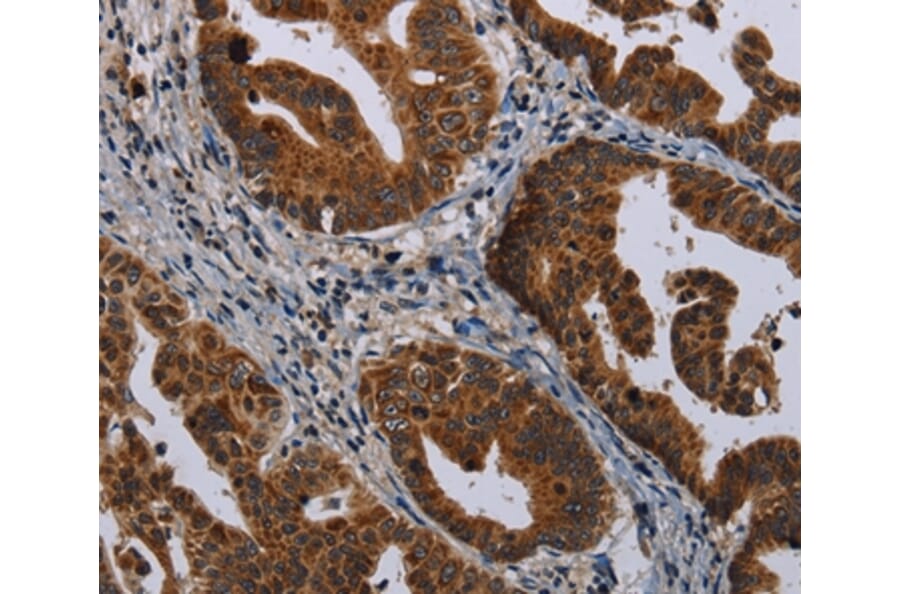 Immunohistochemistry - MAGEB3 Antibody from Signalway Antibody (37707) - Antibodies.com