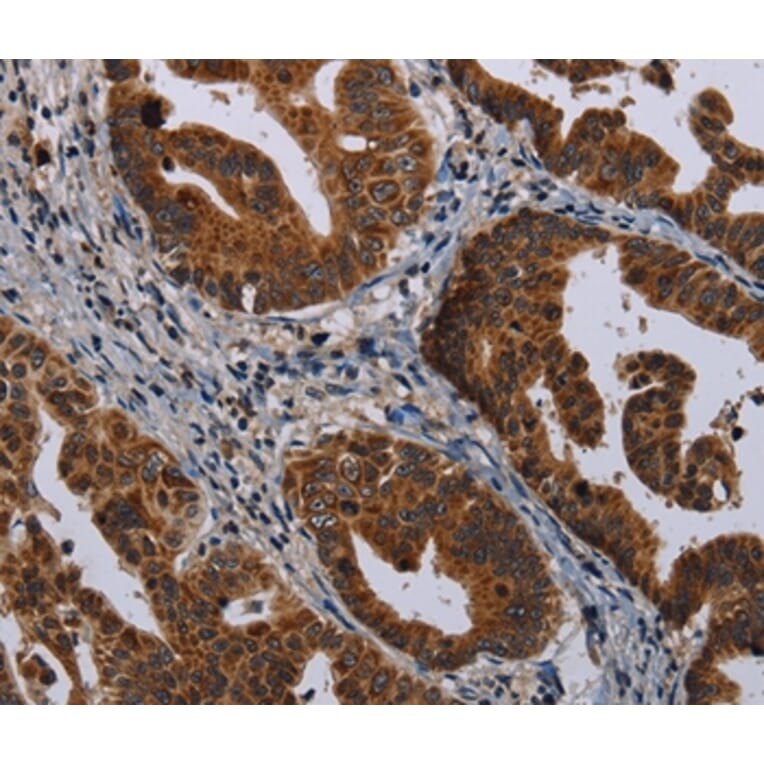 Immunohistochemistry - MAGEB3 Antibody from Signalway Antibody (37707) - Antibodies.com