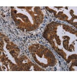 Immunohistochemistry - MAGEB3 Antibody from Signalway Antibody (37707) - Antibodies.com