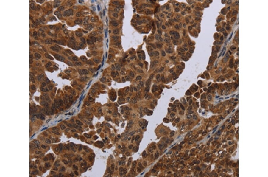 Immunohistochemistry - MAGEB3 Antibody from Signalway Antibody (37707) - Antibodies.com
